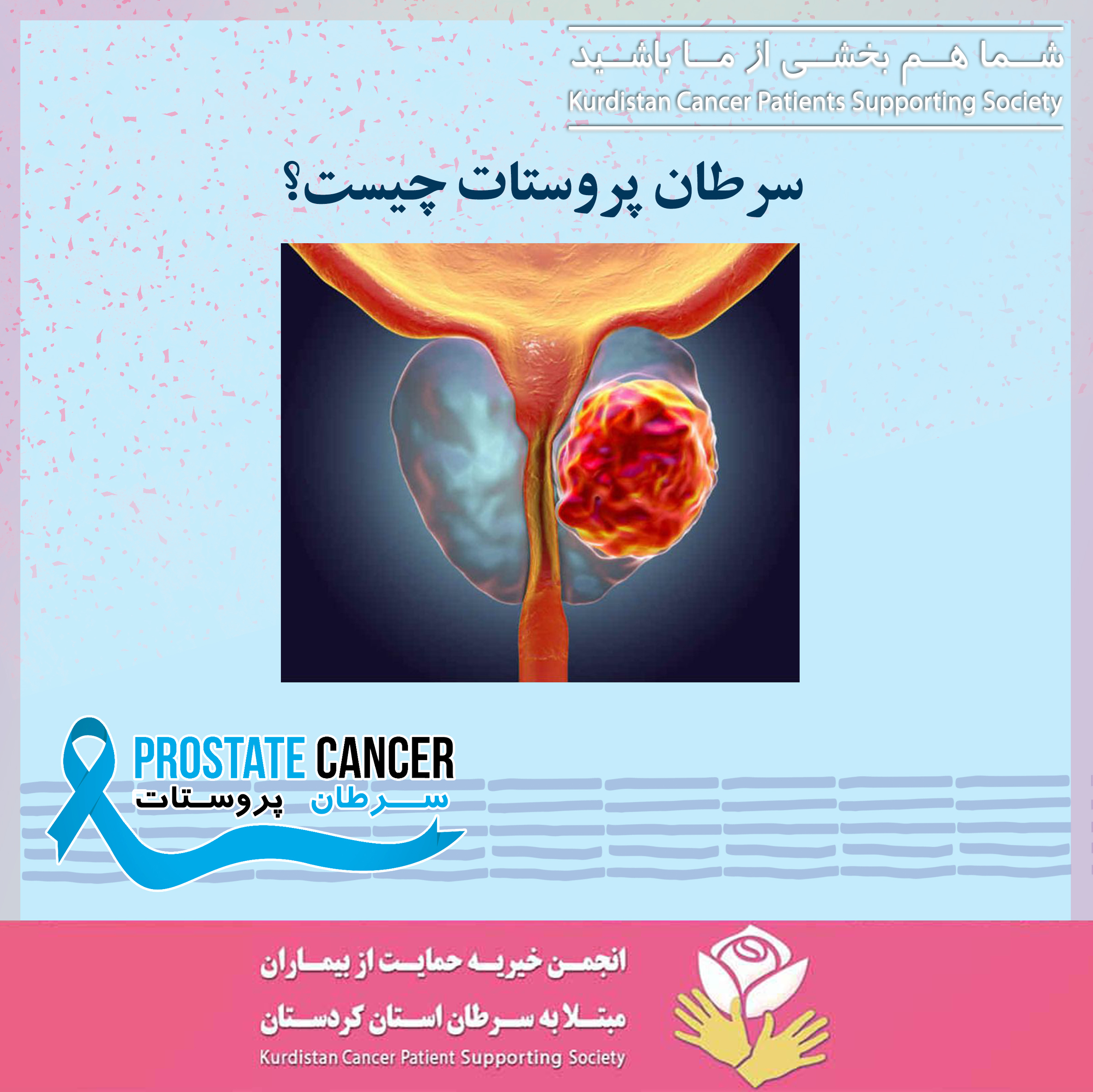 سرطان پروستات